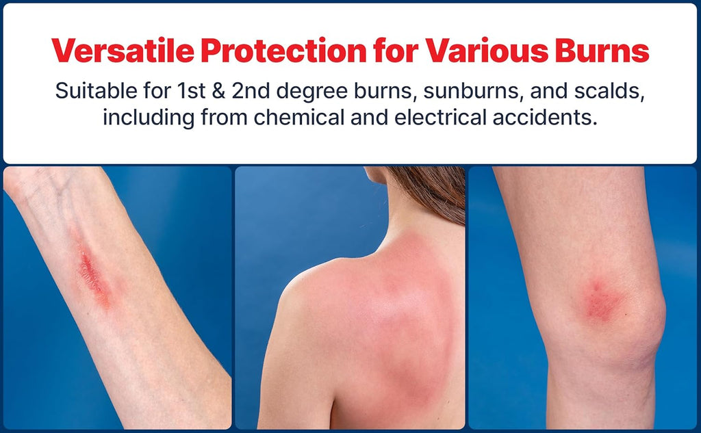 BurnFix Burn Kit First Aid Recommended by Doctors